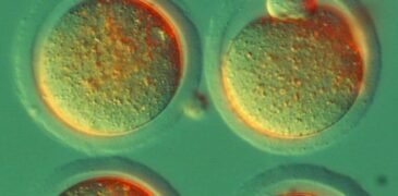 Hope for HIV Patients: The Potential of Stem Cell Transplantation