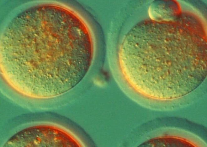 Hope for HIV Patients: The Potential of Stem Cell Transplantation