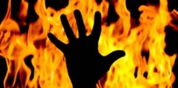Woman Set on Fire Following Minor Dispute in Islamabad