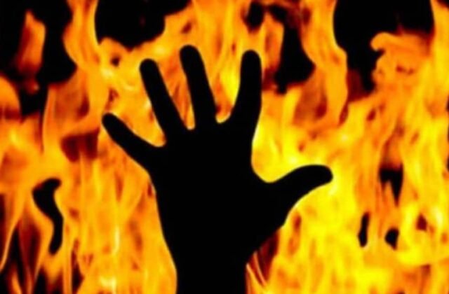 Woman Set on Fire Following Minor Dispute in Islamabad