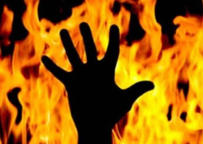 Woman Set on Fire Following Minor Dispute in Islamabad