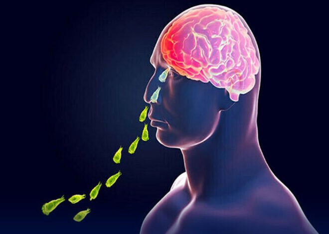 Naegleria Fowleri Claims 5th Victim in Karachi as Deadly Amoeba Continues to Threaten