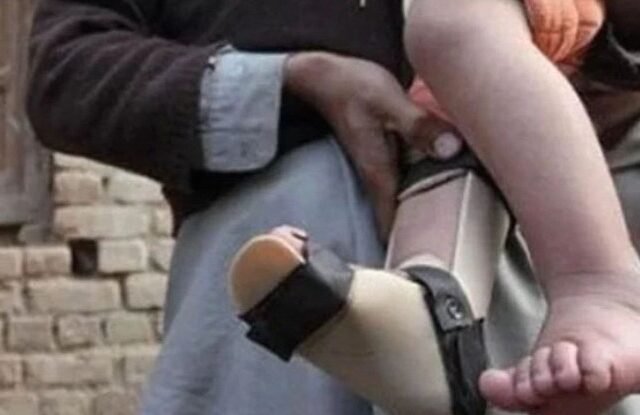 Four More Polio Cases Reported in Pakistan, Tally Reaches 32