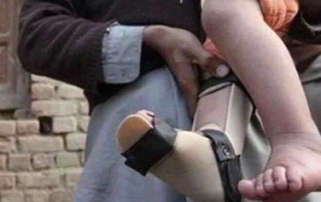 Four More Polio Cases Reported in Pakistan, Tally Reaches 32