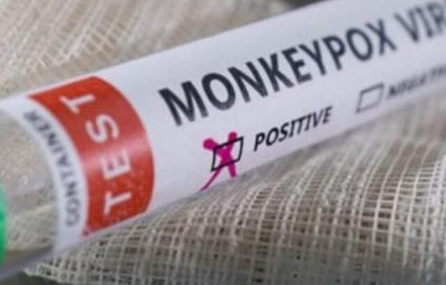 Passenger at Karachi Airport Tests Positive for Monkeypox Amid Global Health Concerns