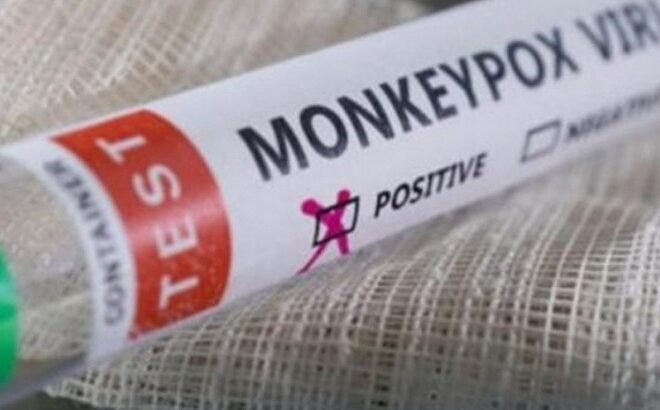 Passenger at Karachi Airport Tests Positive for Monkeypox Amid Global Health Concerns