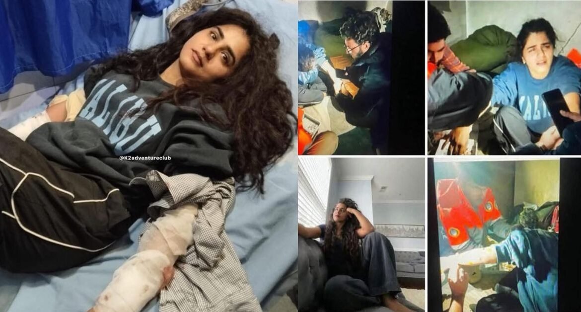 Renowned Singer Quratulain Baloch Injured in Bear Attack at Deosai National Park
