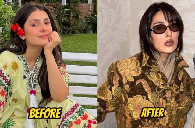 Ayeza Khan Surgery: Ayeza Khan's Changing Appearance Sparks Cosmetic Surgery Speculation